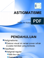 Astigmatisma