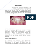 Trauma Oclusal