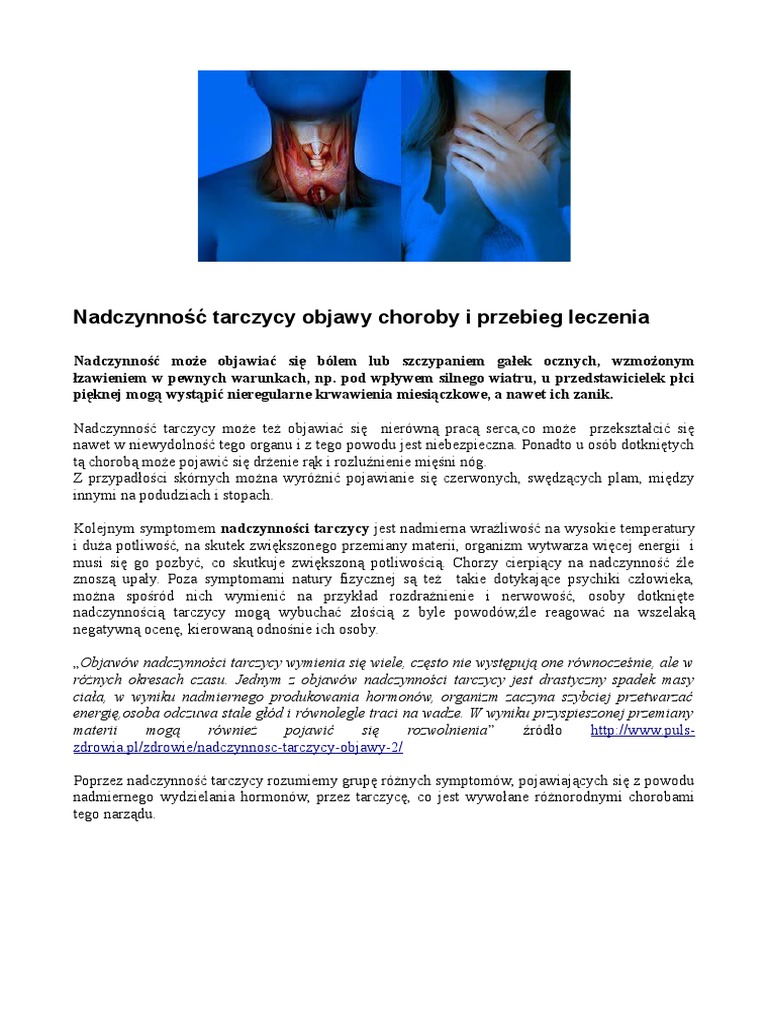 Powiększenie Gruczołu Tarczycy Krzyżówka Nadczynnosc tarczycy, objawy i leczenie