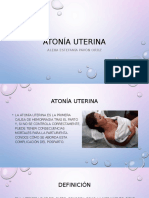 Atonía uteriana