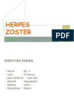 herpes zoster ppt