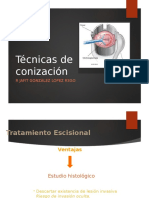 Tecnicas de Conizacion