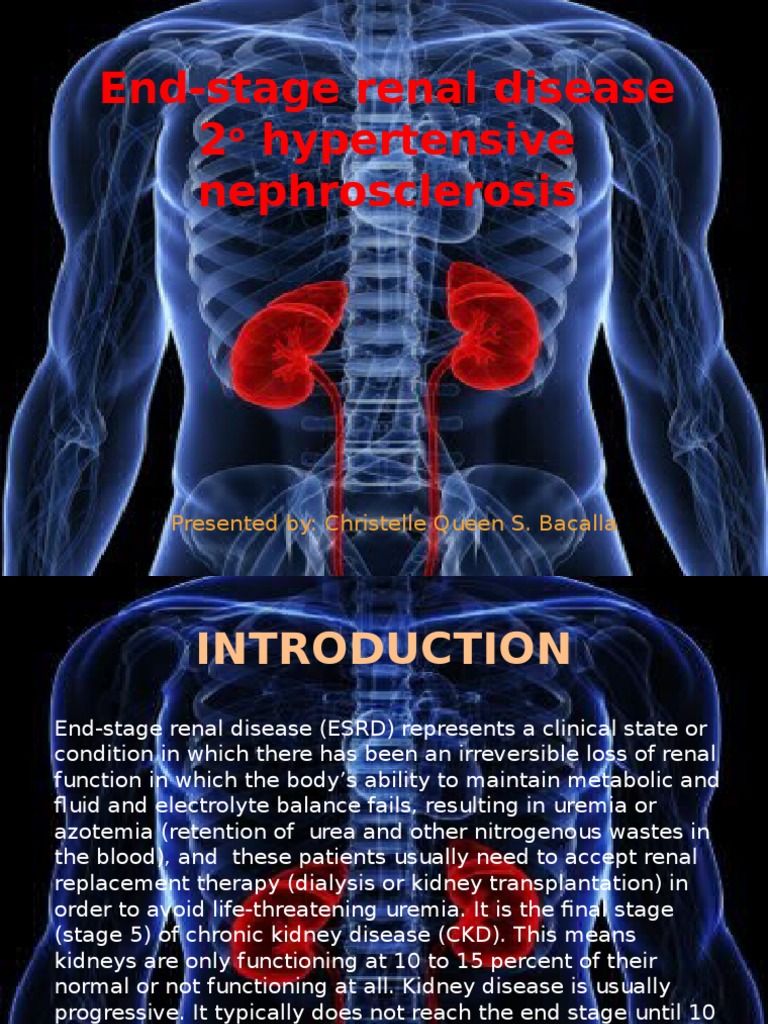 End Stage Renal Disease 2o Hypertensive Nephrosclerosis Kidney