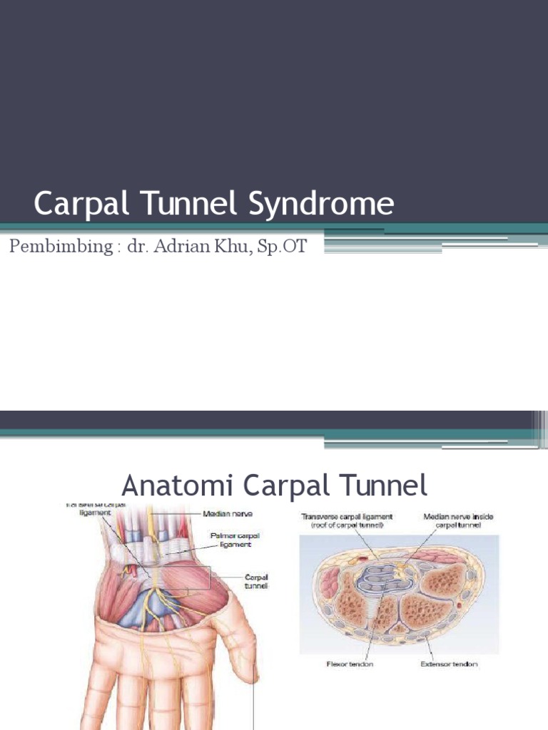 Carpal Tunnel Syndrome PPT