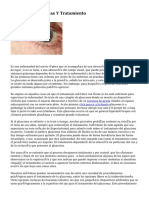 Glaucoma, Síntomas Y Tratamiento
