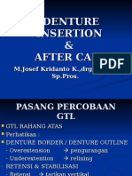 Denture Insertion