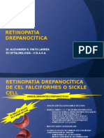 Retinopatía Drepanocítica