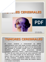 Proceso de Atencion de Enfermeria A Ptes Con Tumores Cerebra Les