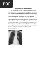 Download Batuk Dan Sesak Nafas Tak Kunjung Hilang PPOK by Dean Gama SN305403845 doc pdf
