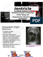Hypoplastic Ventricle. MEDI
