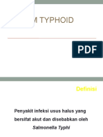 Tifoid