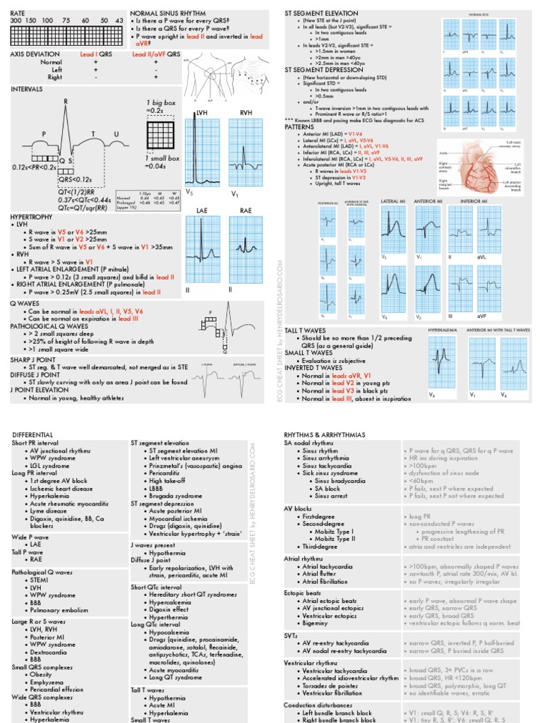 ECG Interpretation Cheat Sheet | PDF | Electrocardiography | Cardiac ...