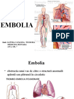 Embolia