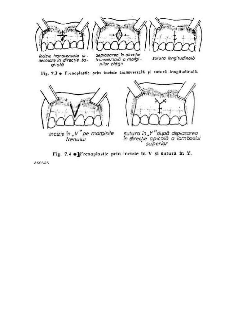 Frenulum Overview and Insights | PDF