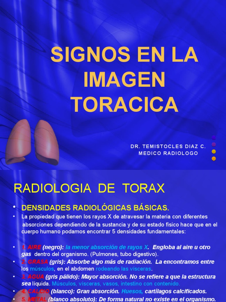 Signos Radiológicos en Imagen Torácica | PDF | Rayo X | Tórax