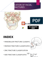 Facial Fractures Classification