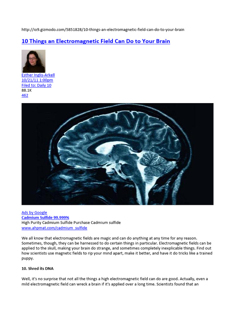 Field and Human Brain Electron Atoms