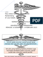 Oligodendroglioma: Tumor Otak Langka