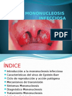  TRABAJO Mononucleosis