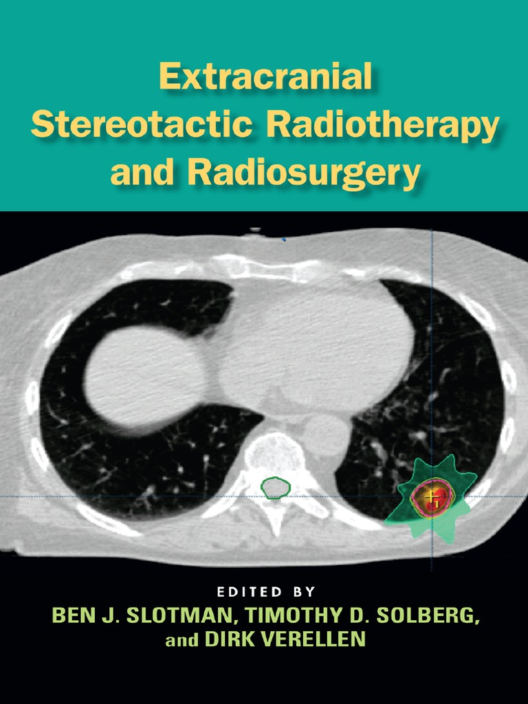 SPIKE RECORDINGS -DESPIKEY- TEEシャツ Extracranial Stereotactic Radiotherapy and Radiosurgery