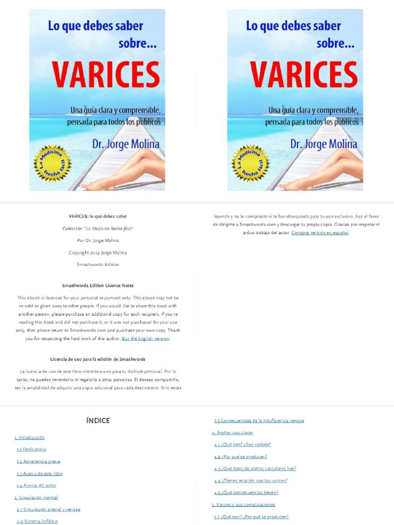 Varices | PDF