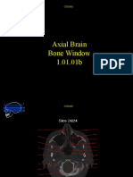 Axial Brain Bone Window 201b