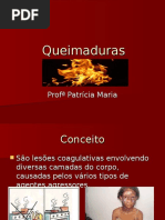 Queimaduras 3ª Slides