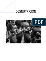desnutricion