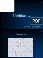 urolitiasis