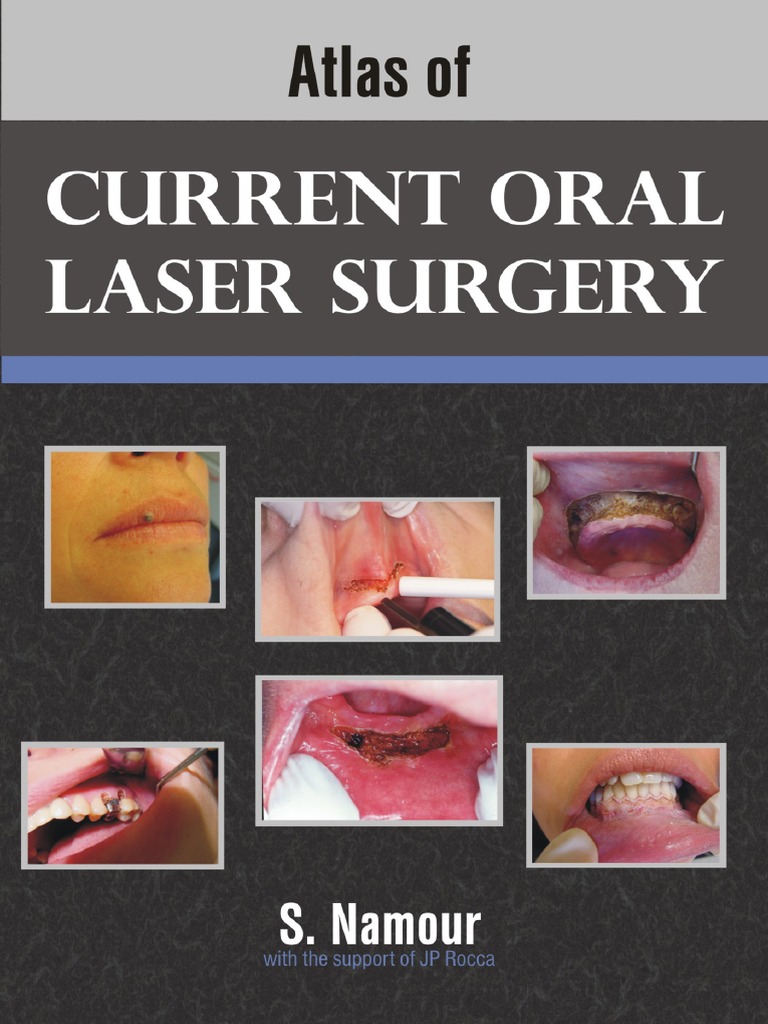 Atlas of Current Oral Laser Surgery PDF Radiation Laser