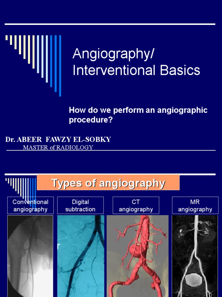 Angiographybasicsandseldingertechnique Angiography Clinical