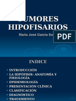 Tumores Hipofisarios
