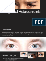 Congenital Heterochromia
