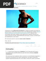 Balanite - Como tratar em 5 passos.pdf