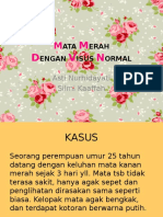 Mata Merah Visus Normal (PSSS I)