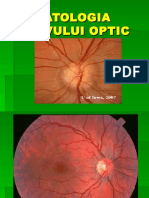 Patologia Nervului Optic