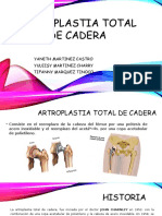 Artroplastia Total de Cadera Yuleisy