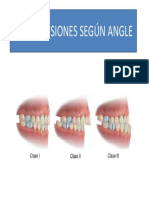 Maloclusiones Según Angle