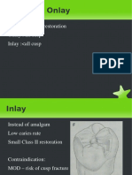 Inlay Onlay