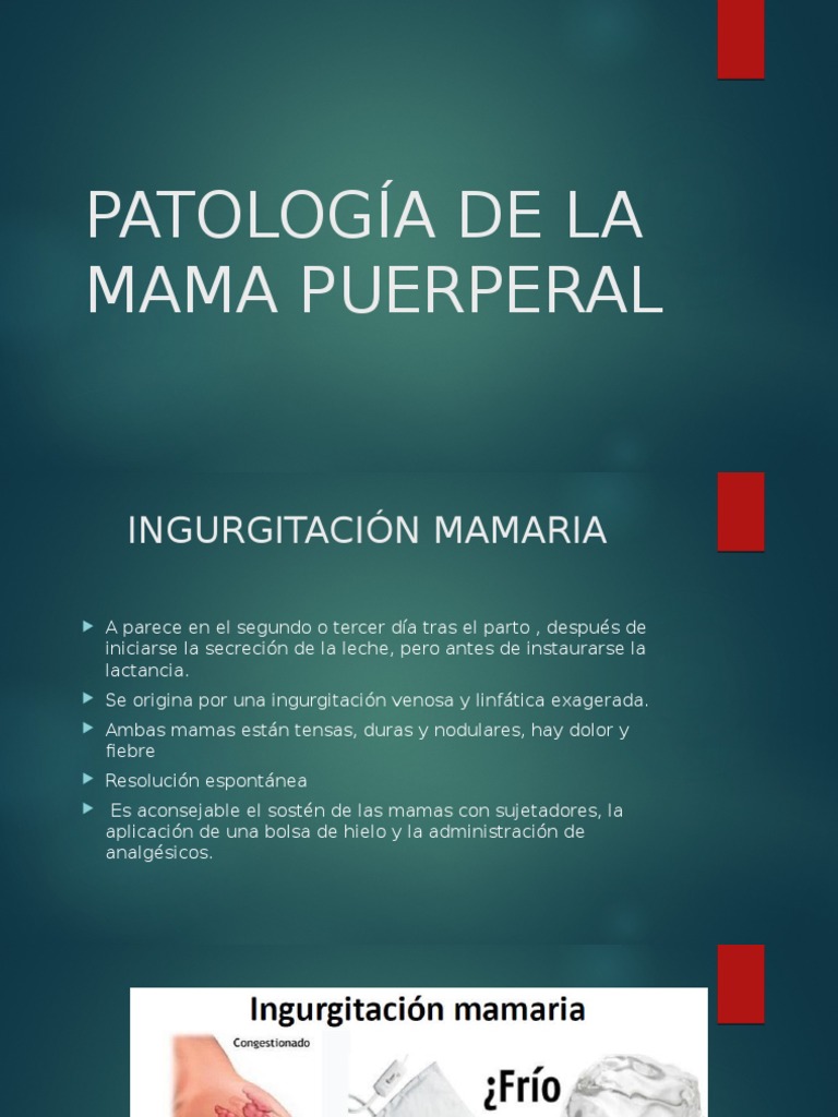 Mastitis Puerperal: Síntomas y Tratamiento | PDF | Pecho | Inmunología