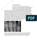 Arthritis Inflamasi Dengan Osteoarthritis Sekunder