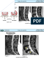 Lumbal MRI