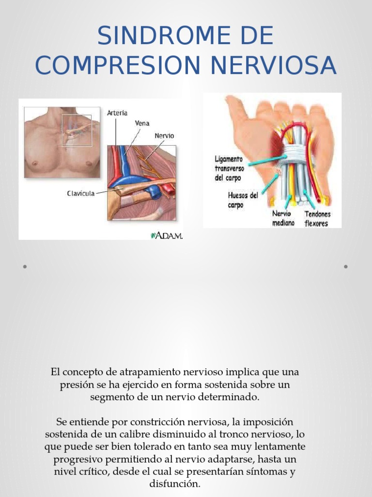 Sindrome de Compresion Nerviosa PDF Extremidades (anatomía