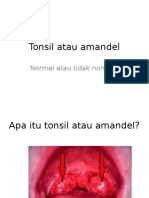 Tonsil Atau Amandel