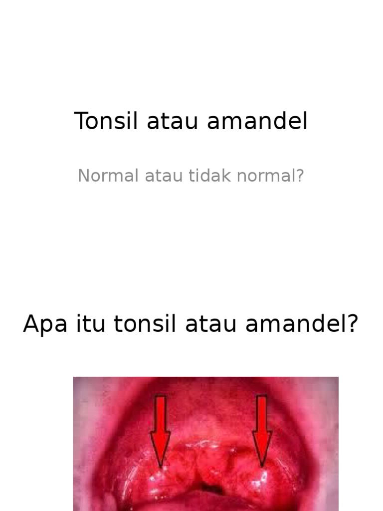 Ukuran dan Masalah Amandel Normal | PDF