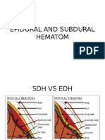 Epidural vs Subdural Hematoma: Types of Brain Bleeding
