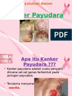 kanker payudara 