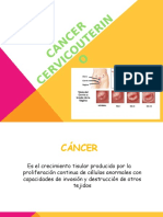 Cáncer Cervicouterino