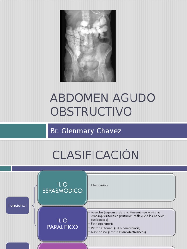 Abdomen Agudo Obstructivo PDF Abdomen Intestino grueso