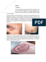 Tipos de Leishmaniasis